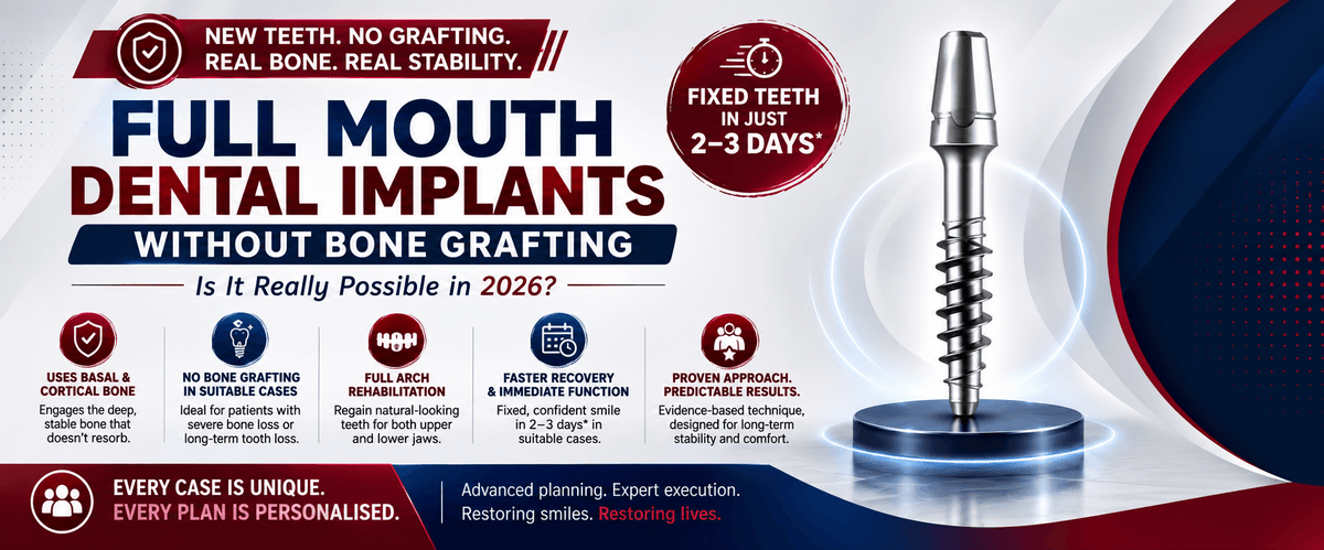 Read more about the article Full Mouth Dental Implants Without Bone Grafting: Is It Really Possible in 2026?