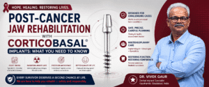 Read more about the article Post-Cancer Jaw Rehabilitation with Corticobasal® Implants: What Patients Need to Know