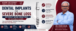 Read more about the article Dental Implants for Severe Bone Loss: The Corticobasal® Solution That Skips Bone Grafting in Suitable Cases
