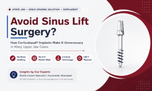 Read more about the article Avoiding Sinus Lift Surgery: How Corticobasal® Implants Make It Unnecessary in Many Upper Jaw Cases