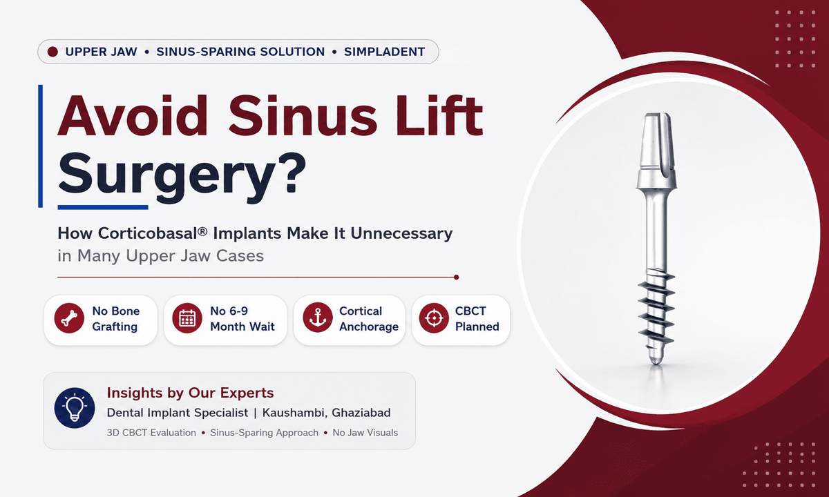 Read more about the article Avoiding Sinus Lift Surgery: How Corticobasal® Implants Make It Unnecessary in Many Upper Jaw Cases