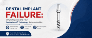 Read more about the article Dental Implant Failure: Why It Happens and How Corticobasal® Technology Reduces the Risk