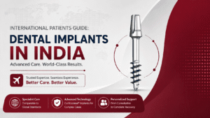 Read more about the article International Patients Guide: Getting Dental Implants in India with Dr. Vivek Gaur