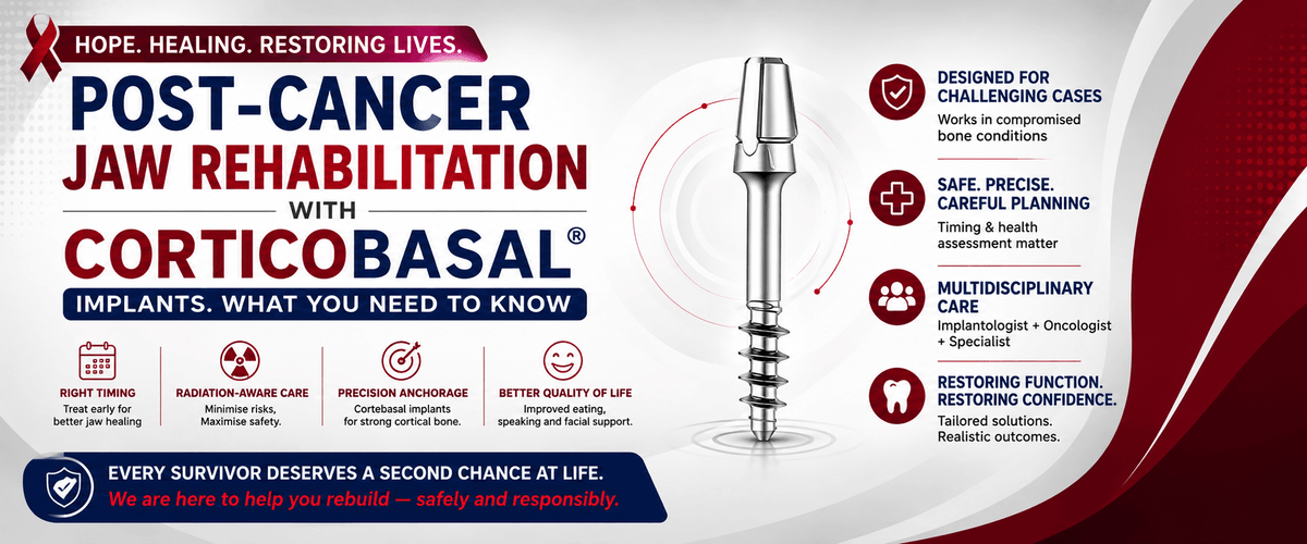 You are currently viewing Post-Cancer Jaw Rehabilitation with Corticobasal® Implants: What Patients Need to Know