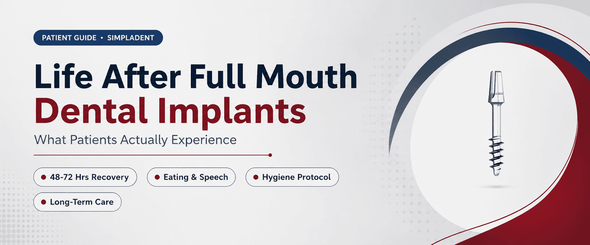 Read more about the article Life After Full Mouth Dental Implants: What Patients Actually Experience — A Practical Guide